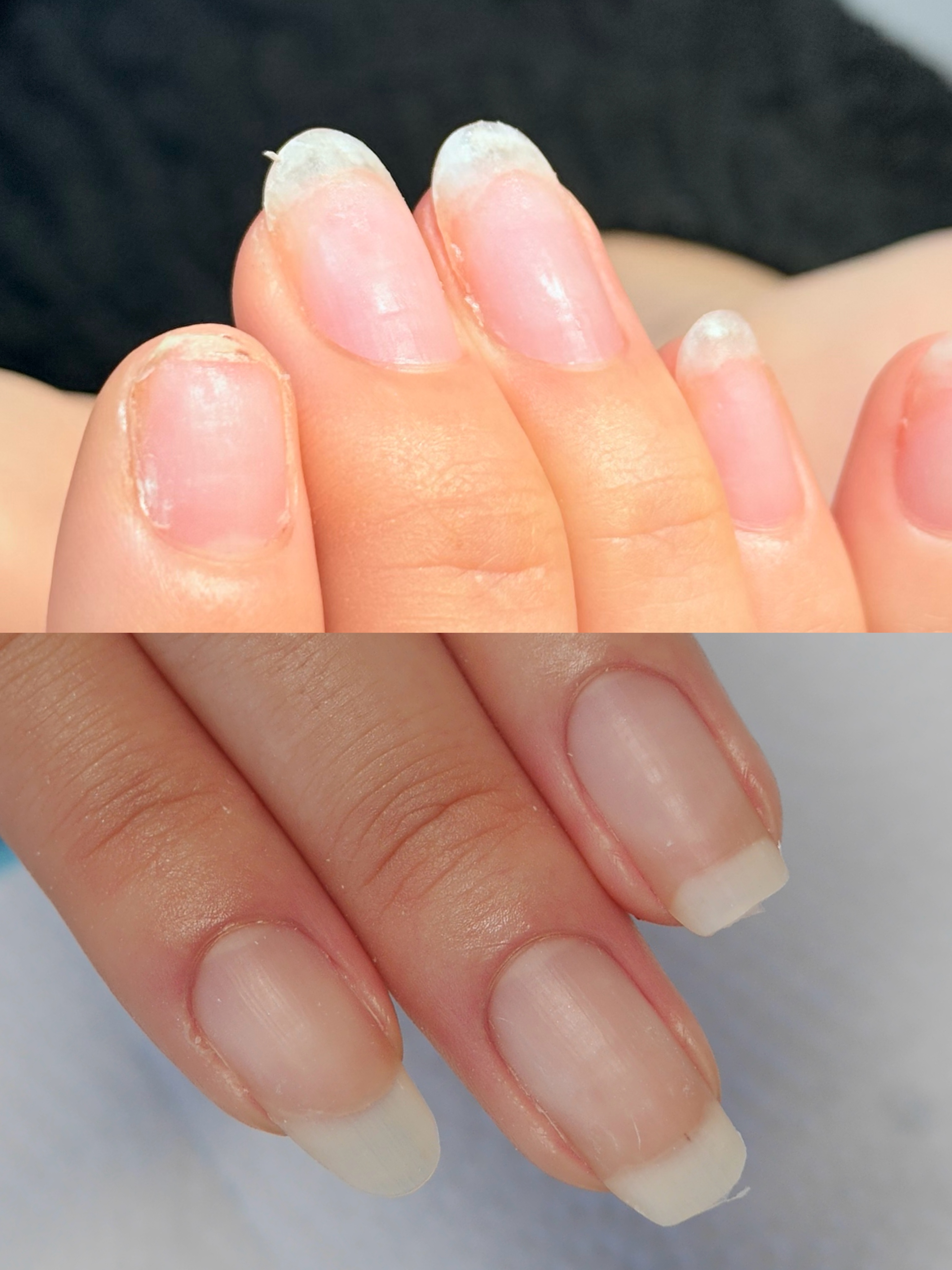 削りすぎや無理なオフで傷んだ自爪と、健康に整った自爪のビフォーアフター