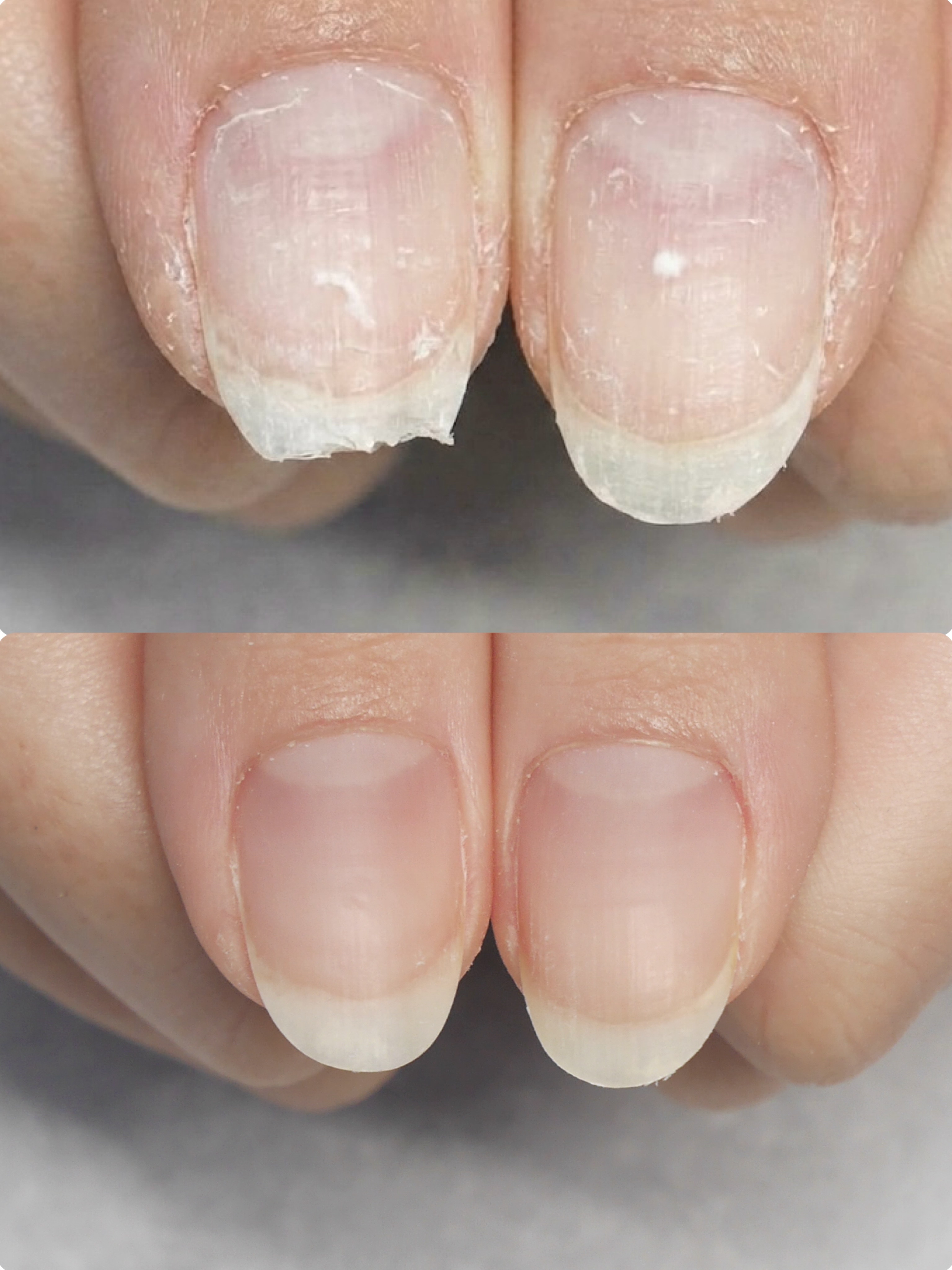 ジェルネイルアレルギーの原因と対策｜COSMOS NAIL
